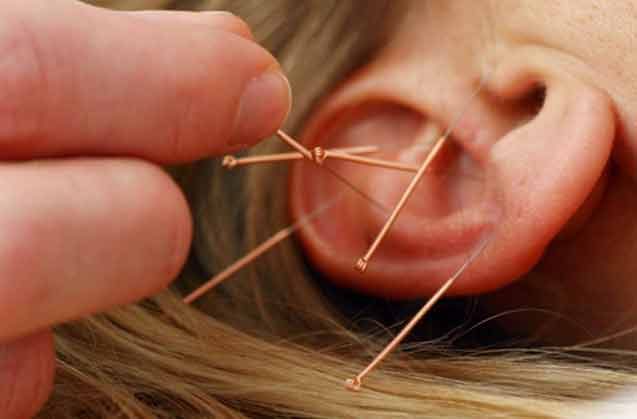 Akupunktur Hangi Hastalıklarda Uygulanabilir?